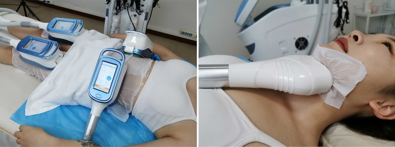 Charmstar Cryo plus 2